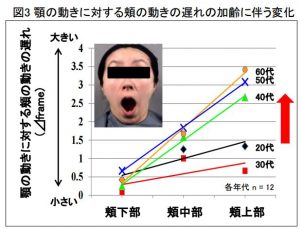 ポーラが新発見 老け顏 の原因は目や口より 頬 にあった Cancam Jp キャンキャン