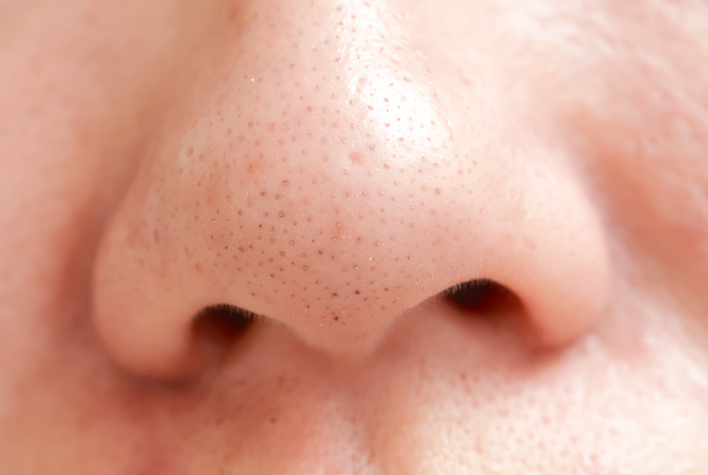 方法 毛穴 を なくす 皮膚科医に聞く！いちご鼻の黒ずみ毛穴を綺麗にする方法