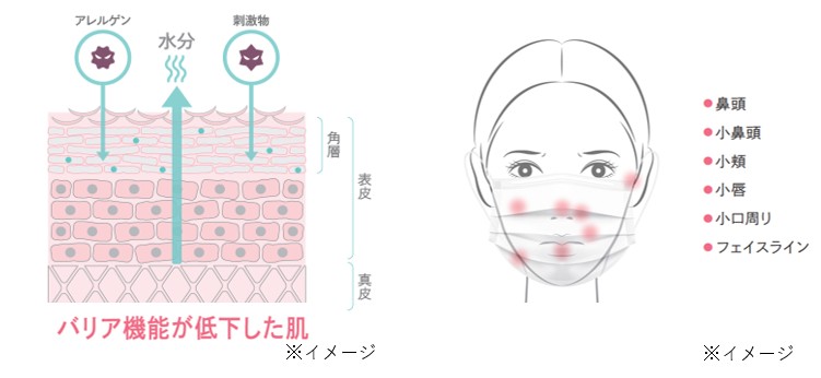 マスク敏感肌？原因と有効なスキンケア