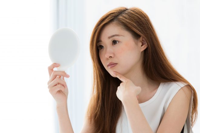 ニキビの占いって根拠は何 令和最新版 できた場所でわかる運勢の理由 Cancam Jp キャンキャン