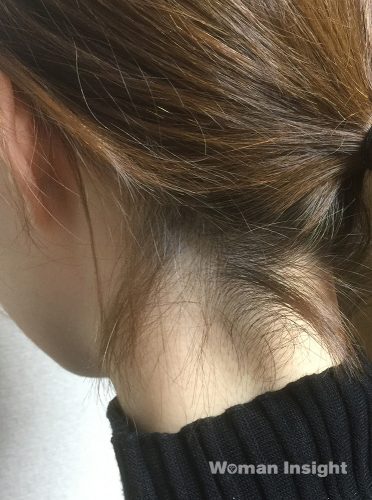 うぶ毛剃り,before