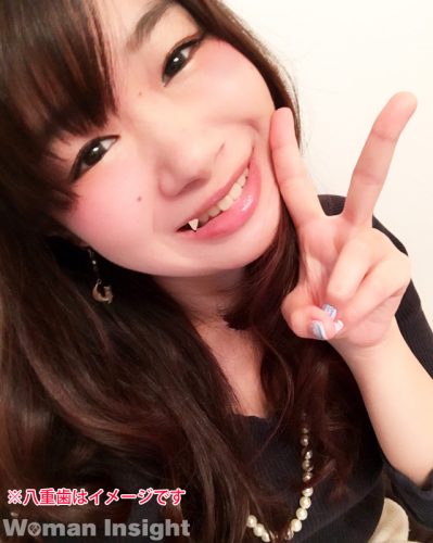 八重歯イメージ