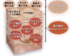 紫外線,UV,肌トラブル,10のトラブル,美白