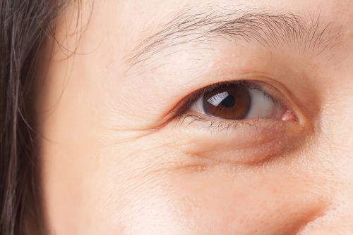 (C)rukxstockphoto/shutterstock