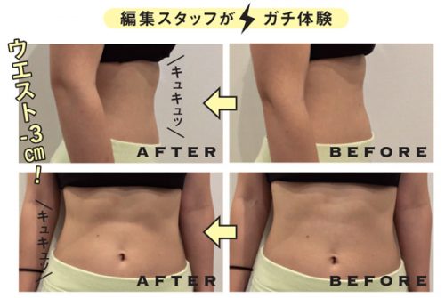 骨盤枕,ウエスト,お腹,お尻,小尻,即効,ビフォー,アフター