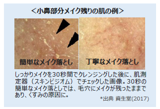 小鼻部分メイク残りの肌の例