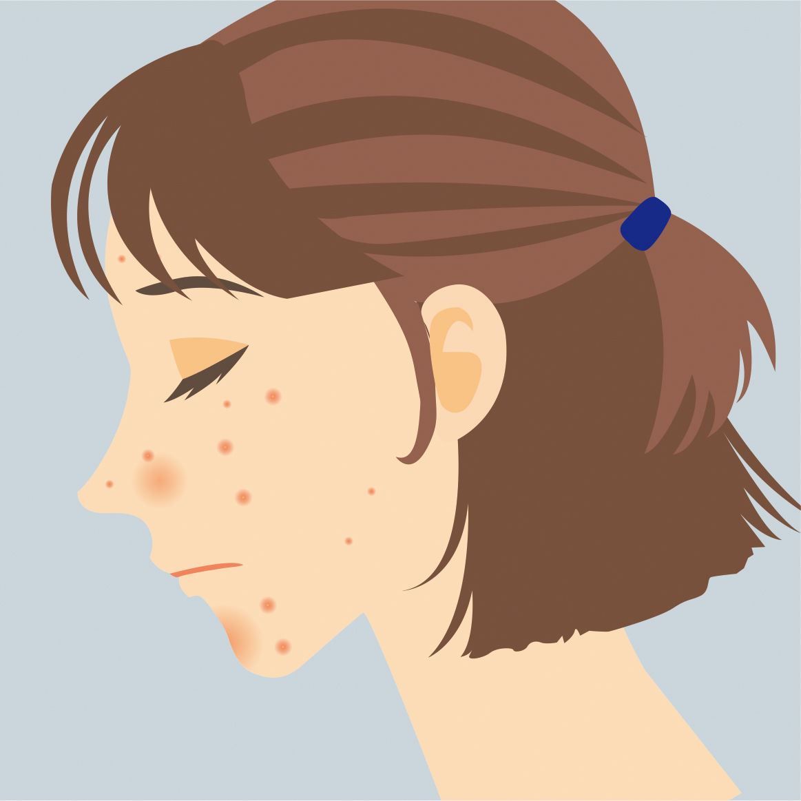 ニキビの人の画像