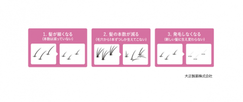 頭皮密度